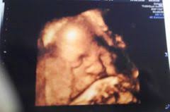 Schwangerschaftswoche entwicklung mutter & baby in der 29. 29 Schwangerschaftswoche 29 Ssw Alle Infos Eltern De