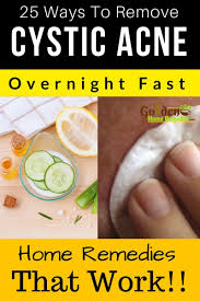 Natural Cystic Acne Treatments That Really Work Cystic Acne Treatment Acne Cure Cystic Acne