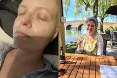 Sepsis: Futbolista de 21 años es internado por una gripe y terminan  amputándole las piernas