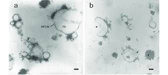 Total raised £0.00 + £0.00 gift aid hannah raised £0.00 laura raised £0.00 cancer is happening right now, which is why we're fundraising right now for cancer research uk. Tem Micrographs Of Fat Globules Fg In Once A Or Twice B Download Scientific Diagram