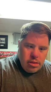 Cómo mantener mis dientes durante la tormenta