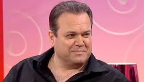 Shaun Williamson Hair Transplant Results
