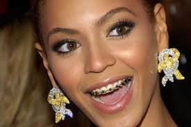 Invisible & Clear Braces | The Smile & Facial Rejuvenation Clinic |  Smilerejuve.Com