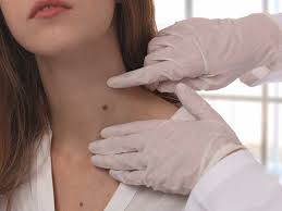 Benign tumors usually don't grow back. Benign Tumors Causes Symptoms Diagnosis