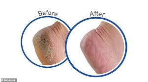 Are usually extremely dry with cracks i used this cream for 10 days and got awesome results. O Keeffe S For Healthy Feet Is A Must Have Foot Cream For Dry Cracked Skin Daily Mail Online