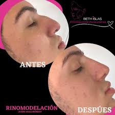 Dra Elizabeth Islas Endodoncia