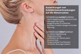 Der faden kann sowohl beim hausarzt als auch in der krankenhausambulanz gezogen werden. Menstruationsstorungen Welche Rolle Spielt Die Schilddruse