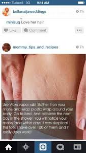 Vicks Vapor Rub Uses For Stretch Marks Mentholatum