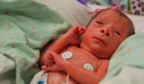 Gardner quadruplets at one week