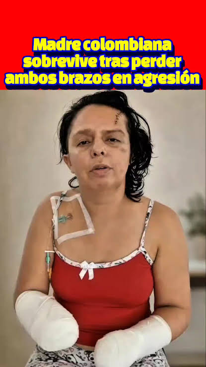 Conmoción en Colombia: Ureli Almario Gómez, una madre de 37 años, lucha por  su recuperación tras sobrevivir a un brutal ataque con machete perpetrado  por su pareja en Acevedo, Huila. El agresor, ...