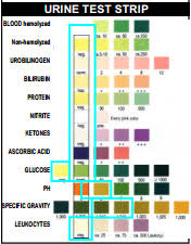 Detailed Urinalysis Chart Results Urine Drug Test Color