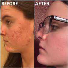 Charlotte Tilbury Collagen Superfusion Face Oil