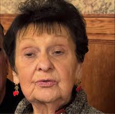 How long after meeting with the surgeon did your surgery take place