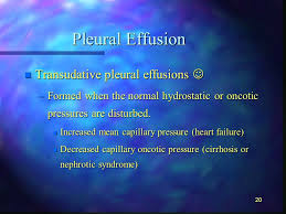 Pleural fluid/serum protein ratio >0.5. 1 Pleural Diseases N Pleural Effusion N Pneumothorax By John J Beneck Pa C Mspa Is That Supposed To Be In There Ppt Download