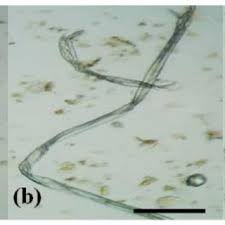 Image result for Gymnosporia oxycarpa