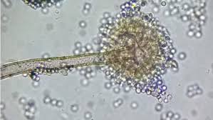 October 2018 aspergillosis is a fungal disease (mycosis) caused by mold fungi of the genus aspergillus, manifested predominant lesion of the respiratory system. World Aspergillosis Day 2019 Causes Symptoms Treatment And Prevention Of The Fungal Infection Latestly