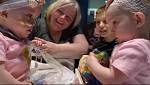  Second formerly conjoined twin heads home