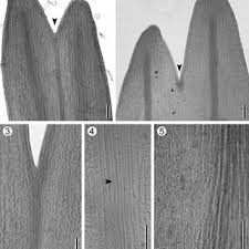 Image result for Asplenium mildbraedii