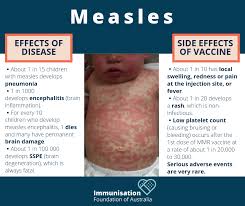 When rates of vaccination within a population are greater than 92%, outbreaks of measles typically no longer occur; Immunisation Foundation Of Australia With The Outbreaks Of Measles Around Australia We Thought It Was The Perfect Time To Weigh Up The Risks Of Measles Infection Vs Measles Vaccination It S Pretty