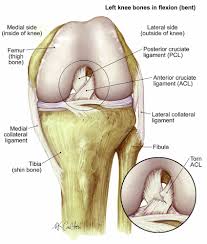 It connects the thigh bone to the shin bone. Anterior Cruciate Ligament Tear Acl Tear The Institute For Athletic Medicine