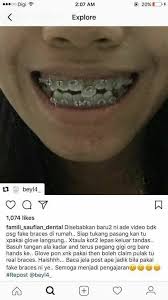 Oh ya perbedaan scoopy sporty dan stylish maupun playful hanya di tampilan saja. Penang Press Braces Rm580 Sekadar Perkongsian Ya Facebook