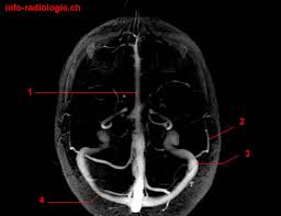 Our database has everything you'll ever need, so enter & enjoy ;) Anatomie Des Intrakraniellen Venensystem