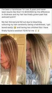 Of course, some people have to thin out their biological hair. Hair Growth Shampoo Suffer From Thinning Hair Receding Hair Line Loss Of Hair Around The Crown A Receding Hair Styles Hair Loss Cure Hairstyles For Thin Hair