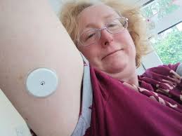 Diabetic nurse campaigns for vital sensor to be made available to all  patients in Devon