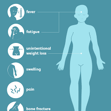 Metastasis means that cancer spreads to a different body part from where it started. Bone Cancer Signs Symptoms And Complications