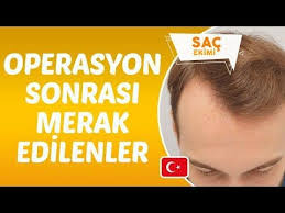 Youtube Sac Ekim