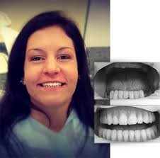Maybe you would like to learn more about one of these? Before After Sodc