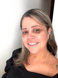 Olá pessoal tirei essa foto hoje é estou postando pra vcs os 15 dias da  minha cirurgia BLEFAROPLASTIA So agradecer ao Dr Ferrer Pardo, foi quem fez  minha cirurgia🥰 Completa superior e