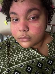 How am I supposed to see the beauty when this has taken over my life! 💔😞