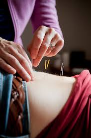 Does blue cross blue shield of ma cover acupuncture. Medicare Now Covers Acupuncture The Martha S Vineyard Times