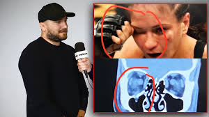 Gamrot trafił palcem w oko irlandczyka, zaś decyzją sędziego marca goddarda walka została uznana za. Koniec Kariery Karoliny Kowalkiewicz Co Bedzie Z Jej Okiem Odpowiada Trener Lukasz Zaborowski Youtube