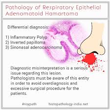 Educational Gif Pathology Of Respiratory Epithelial Adenomatoid Hamartoma Pathology Respiratory Chronic Sinusitis