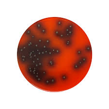 Previous scientific opinion of the biohaz panel. Listeria Selective Agar Polymyxin Acriflavine Licl Ceftazidime Aesculin Mannitol Palcam 90mm Plate Southern Group Laboratory