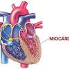 La miocarditis puede afectar el músculo cardíaco y el sistema eléctrico del corazón, lo que reduce la capacidad del corazón de bombear y producir ritmos cardíacos rápidos o anormales (arritmias). 1