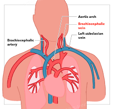 Anatomy Thorax Brachiocephalic Innominate Veins Article I supply the cervical muscles and the spine.