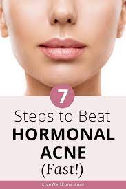 We did not find results for: How To Get Rid Of Hormonal Acne Naturally Fast A 7 Step Plan For Skin Healthy Skin Care Acne Hormonal Acne Get Rid Of Hormonal Acne