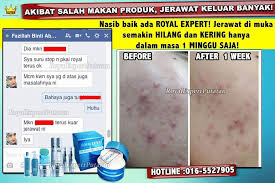 Bagaimana nak dapatkan produk ini atau jika anda ingin menjadi dealer royal expert®; Royal Expert Putatan Publications Facebook