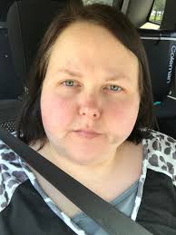 Please help!!! I had a tooth extracted two days ago and a abscess drained.  Today I'm in the worst pain ever goes this look like normal healing???