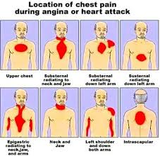 Pin On Health