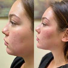 Malik medical aesthetics salaries in mullica hill, nj. Malik Medical Aesthetics Women Owned 44 Photos 16 Reviews Medical Spas 201 Bridgeton Pike Mullica Hill Nj Phone Number Yelp