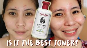 It has a refreshing feel and helps to cleanse away dirt. 1 Week With Thayers Witch Hazel Toner Ph Youtube