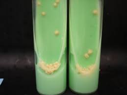 Penicillin or malachite green to inhibit other bacteria 2. Culture On Lowenstein Jensen Medium Revealed Typical Dry Heaped Up Download Scientific Diagram