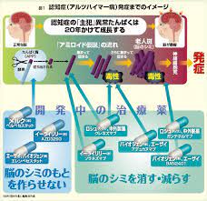 2019年に作ったアニメ映画のフェイク予告映像です。本当は声もあるのですが権利の都合上offにし、左下に字幕をつけました。indie animation gosenhu to tsuki to affogato/movie trailerit is original fake animation movie. ç‰¹é›† èªçŸ¥ç—‡ã«å…‹ã¤ 2017å¹´7æœˆ4æ—¥å· é€±åˆŠã‚¨ã‚³ãƒŽãƒŸã‚¹ãƒˆ