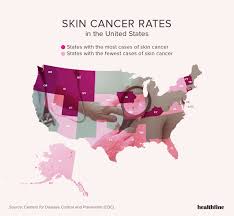 Disease recurrence and survival are two critical measures of prognosis (how a patient will do after a cancer diagnosis). Skin Cancer Facts Statistics And You