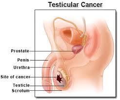 We are not a medical organization or affiliate and urge anyone with urgent questions regarding symptoms etc to contact your doctor or urologist. Testicular Cancer Prognosis