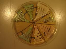 Candida albicans is the most common yeast that we live with. Candida Slakte Wikipedia